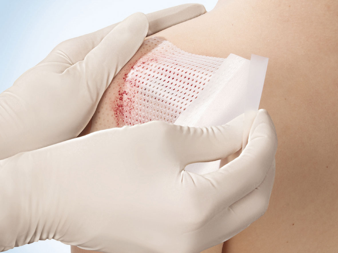 5_woundcare1
